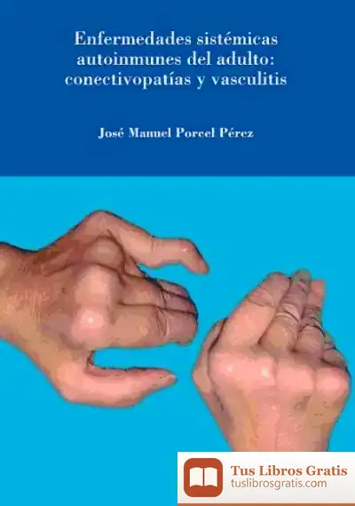 Descargar Enfermedades Sistémicas Autoinmunes Del Adulto: Conectivopatías Y Vasculitis de Juana Gómez Benito