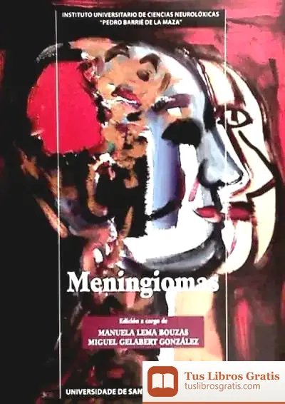 Descargar Op/189-Meningiomas de Julio Trebolle Barrera