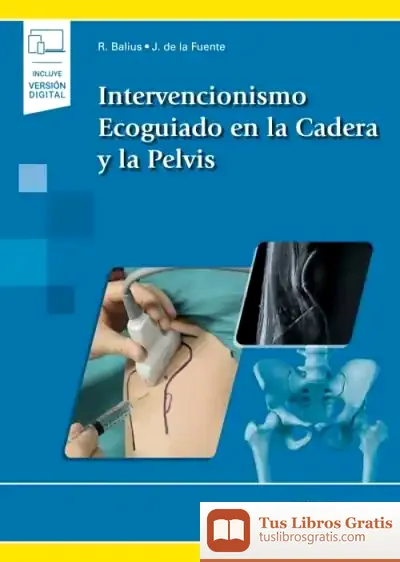 Descargar Intervencionismo Ecoguiado En La Cadera Y La Pelvis